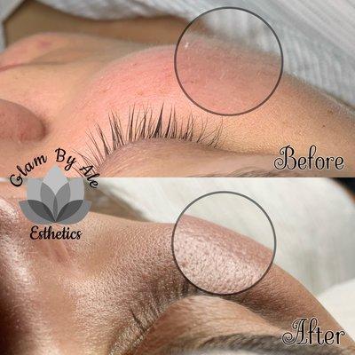 Glam By Ale Esthetics