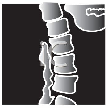 North Texas Spinal Decompression