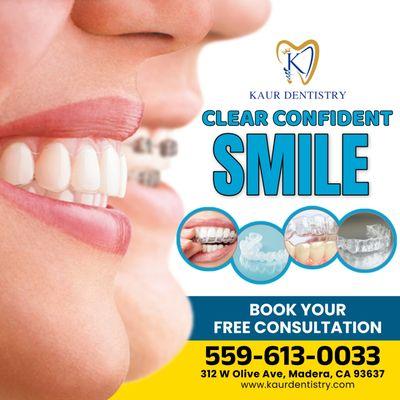Clear Aligners
