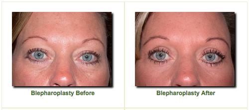 Debra C. Bergman, MD