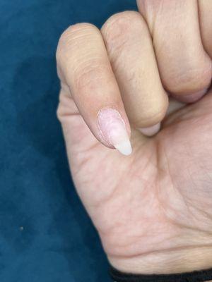 The nail is so much smaller than my finger there was no way to make this look normal