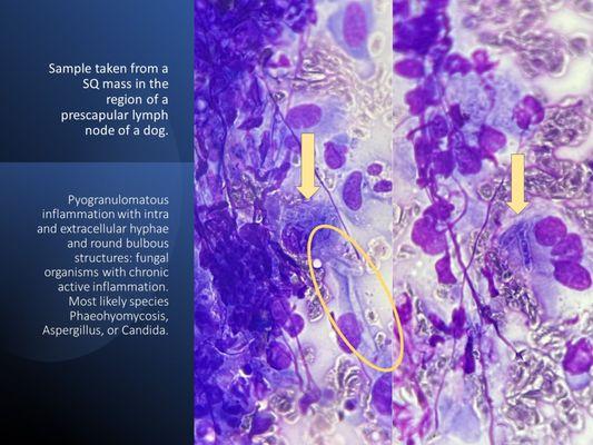 Dr. Treadwell has over 25 years of experience sampling masses and organs to find answers