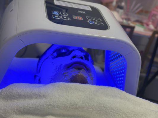 Men's acne treatment with blue light therapy