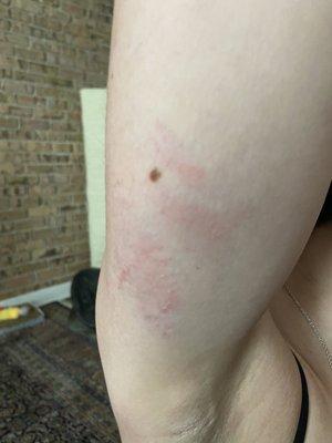 Bouncer sinking his nails into a 21 year old girl