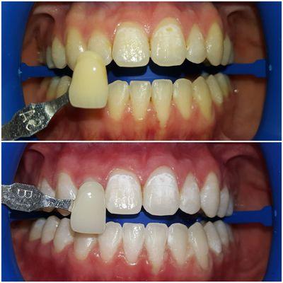 Ketcherside Orthodontics