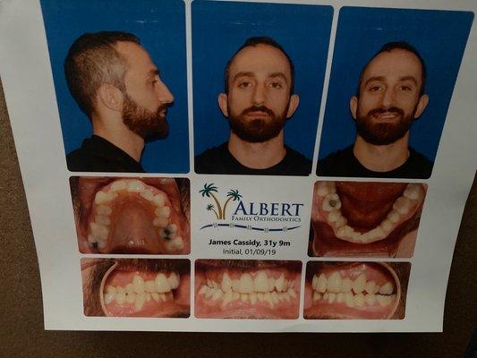 Albert Family Orthodontics PA