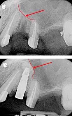 Prasit Aranyarachkul, DDS