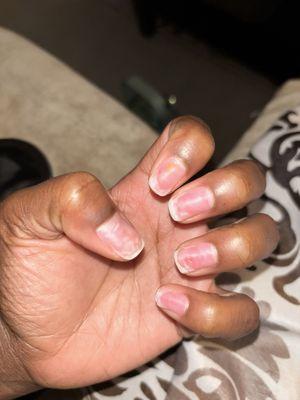 Damaged nails