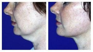 Aesthetic Plastic Surgery Center of Colorado