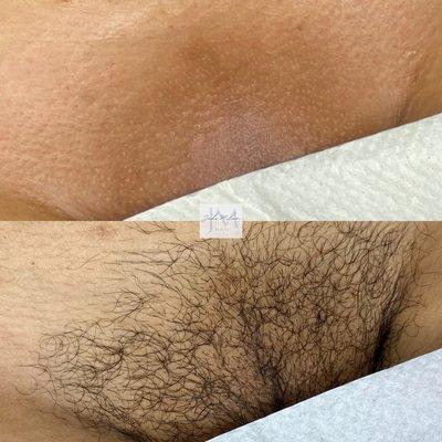 First time client Brazilian wax