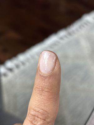 Grainy looking nails