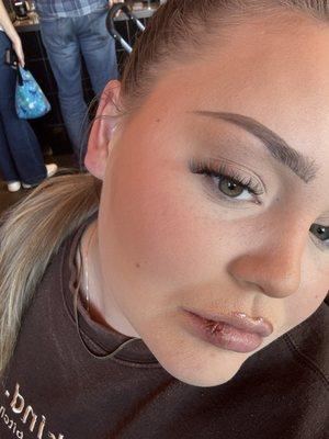 Right after I left the appointment when I got the bleeding to stop.