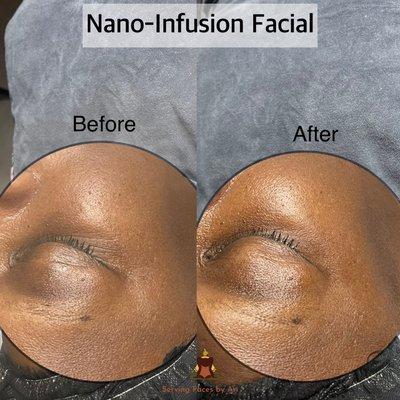 Serving Faces By Ari