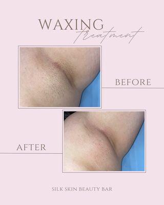 Underarm Wax before and after