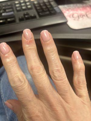 My hands 24 hours after the manicure. You can see where she cut me all those times.