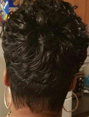 Client's hairstyle after Non Surgical Technique application. 3