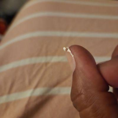 The gel has separated from my nail