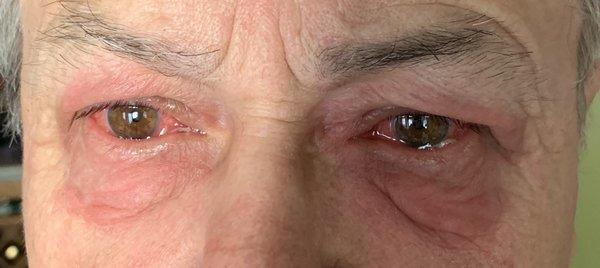 Haroutun Hovanesian,MD