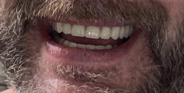 Implants Guru - Keerthi Senthil DDS, MS