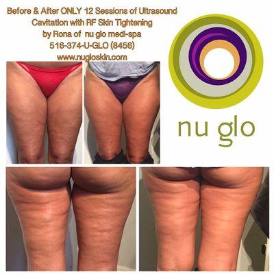 Nu Glo Skin & Laser Spa