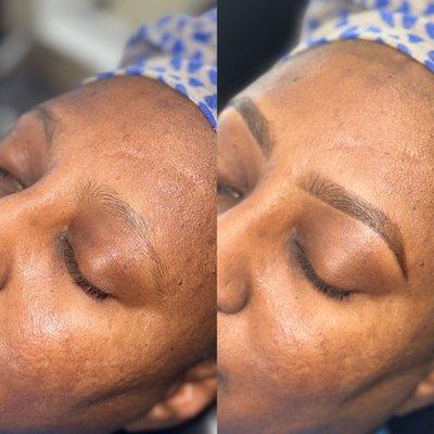 Microshading before and after