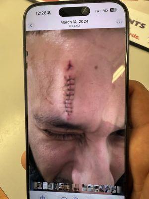 Another picture of the assault Missy Duarte Craig Weiss never submitted this evidence