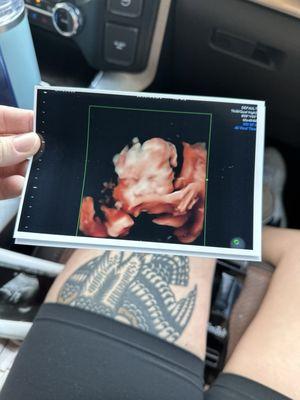 Ultrasound print products