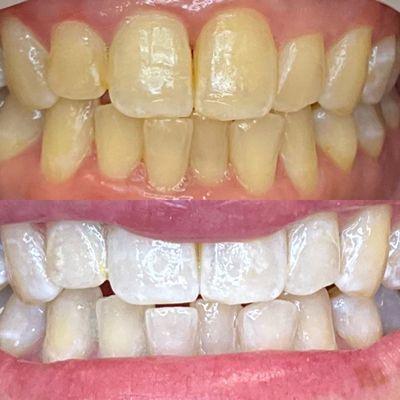 Before and after photos