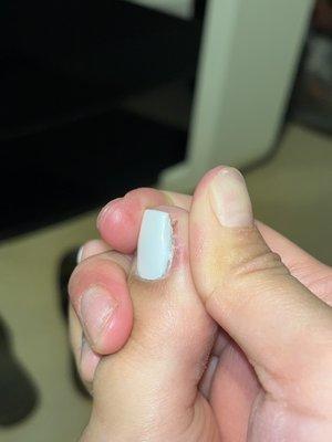 She didn't even do a good job with my ingrown and manage to still cutt me right here