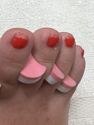 Paint on skin following pedicure.
