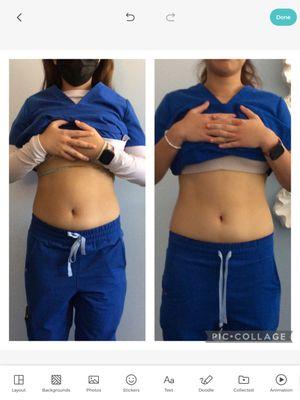 Avalon Body Sculpting & Skin Solutions