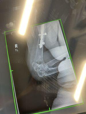 All Florida Orthopaedic Associates