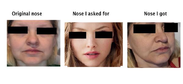 My old nose-The nose he agreed to give me-The nose he actually gave me