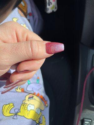 Thumb bubble that I had to peel because it kept getting bigger.