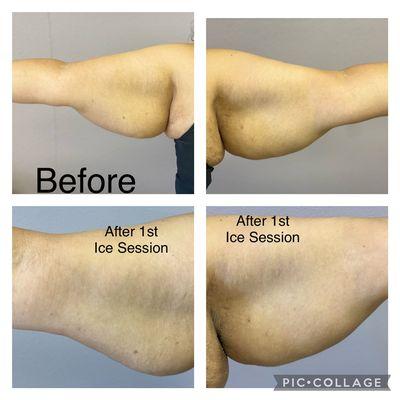 Ice sculpting results