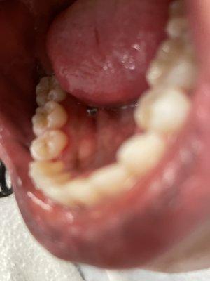 Allure Dental