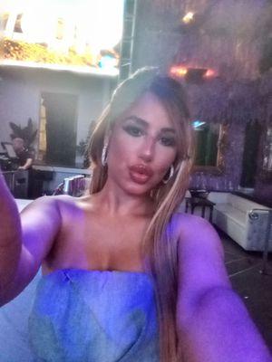 Lips and Botox by her