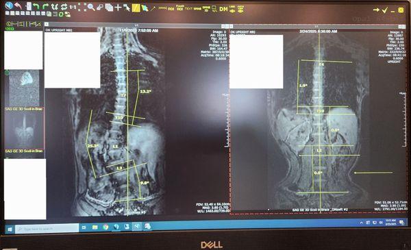 Scoliosis Care Centers