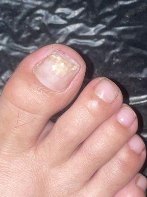 Pronail