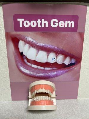 Tooth Gems