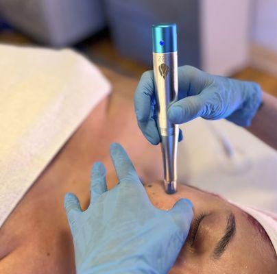 Advanced Skincare done here