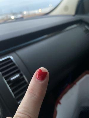 Day after getting gel