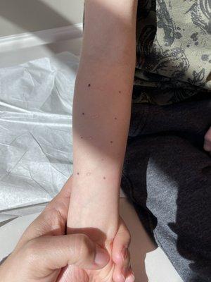 Time for a specific allergy test