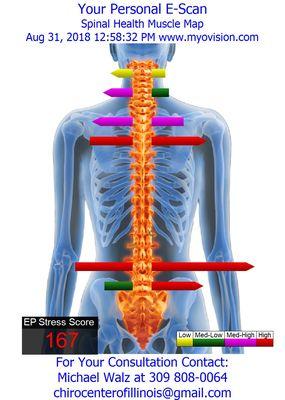 An indication of muscular activity, to show us how subluxations can affect muscular tension and potential imbalances.