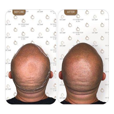 OC Esthetique and Spa