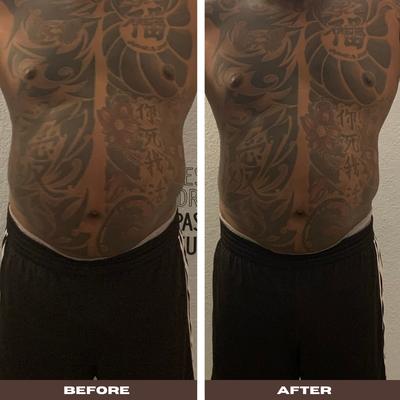 One session of Abdomen Tone and Tighten treatment