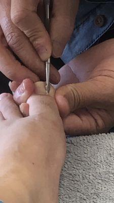 Sharp ass tool diggin deep under my nail