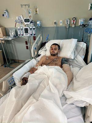 Hospitalized, not residing at service address