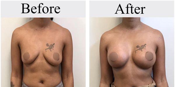 Orland Park Plastic Surgery