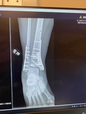 Perrico Health Campus Physical Therapy